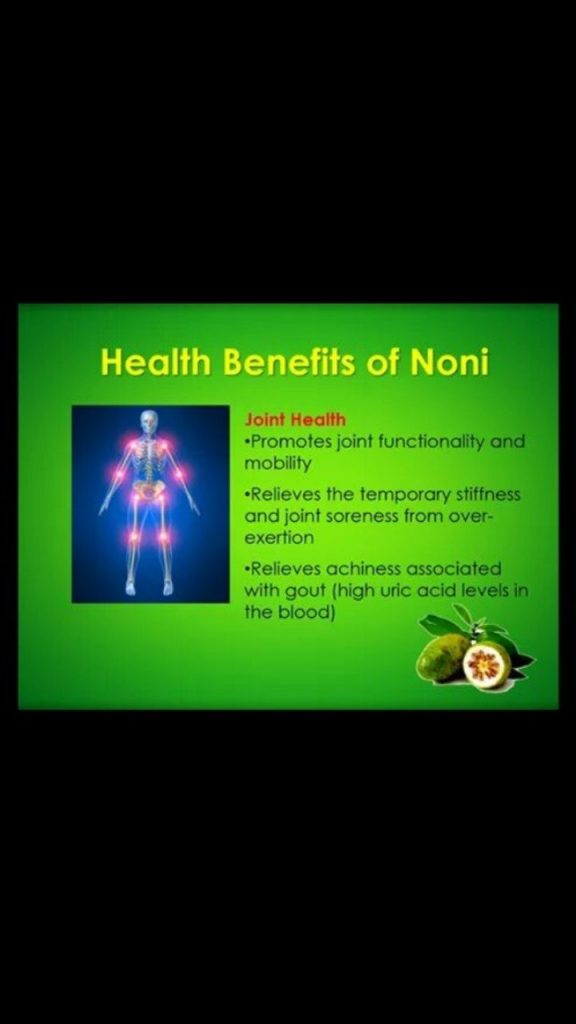 wp_story1612585502407_06933111504828805784.jpg Wp Story1612585502407 06933111504828805784